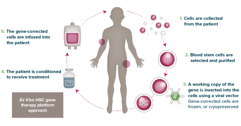 Gene therapy comes in many forms - Orchard Therapeutics